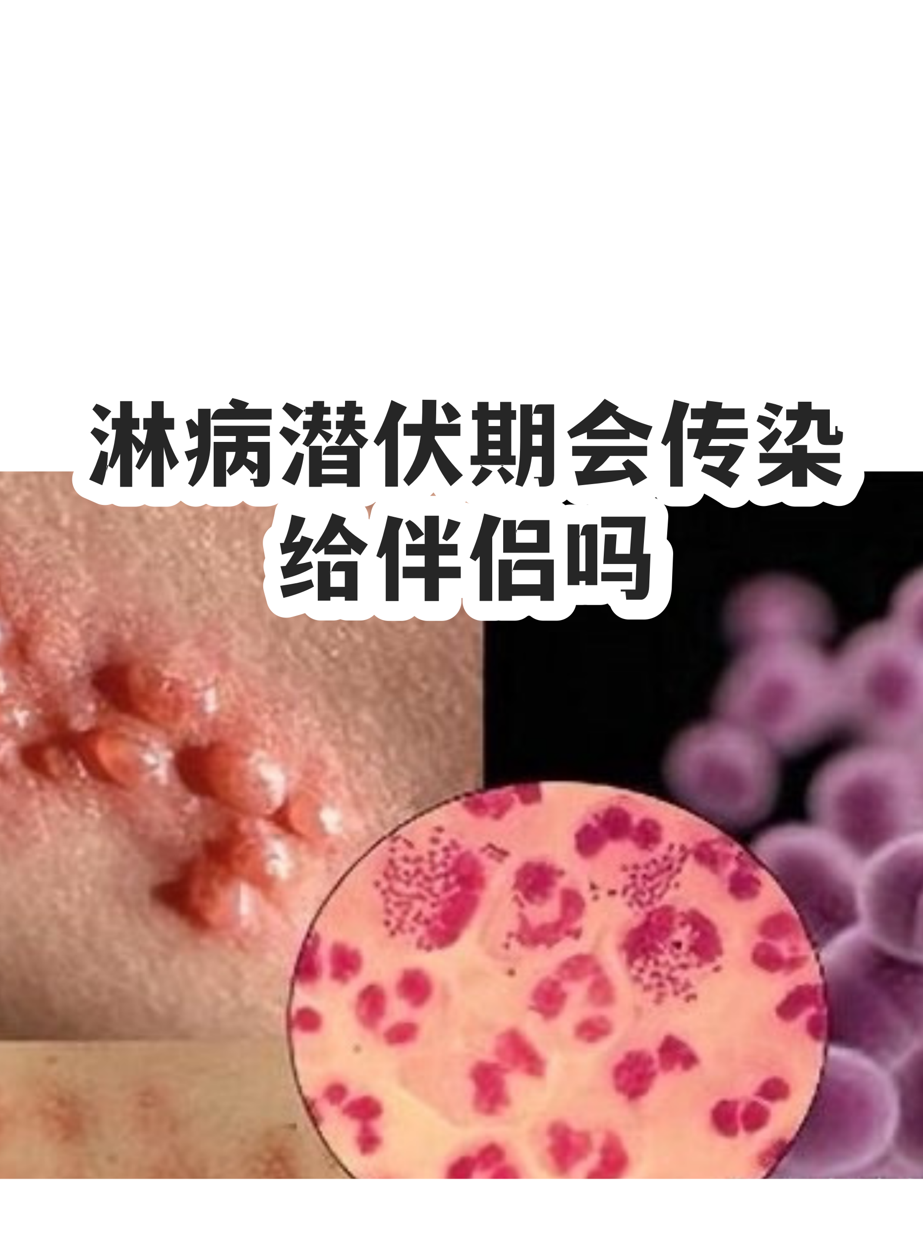 保定:感染者确实不少（最新保定流感事件）